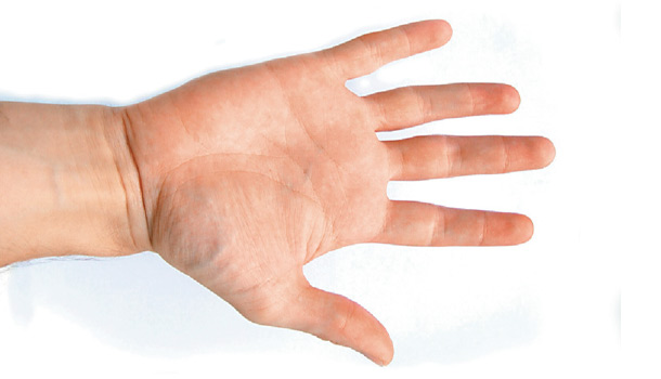 [醫療百科] 手指關節彎曲、疼痛、無法握拳？