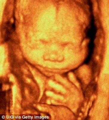 [新聞] 美FDA警告：嬰兒超音波3D照 恐有健康風險